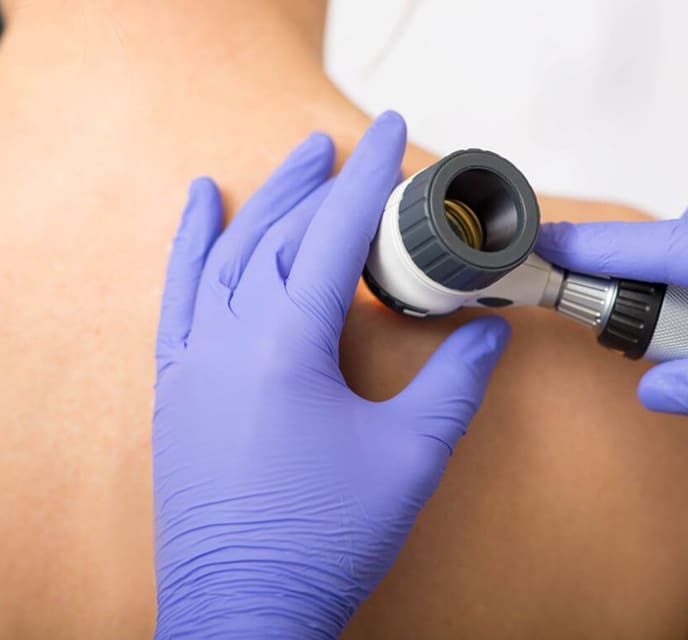 Tratamento para psoríase