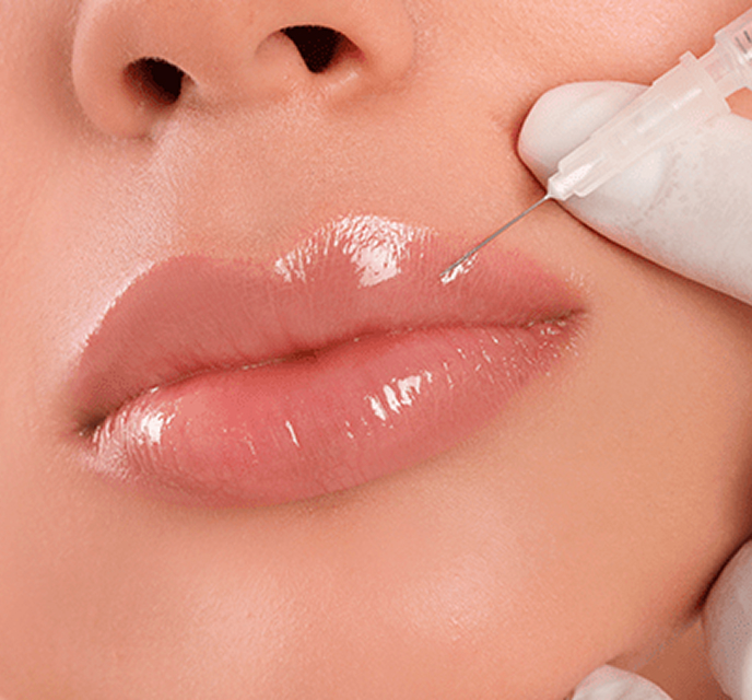 Preenchimento Labial